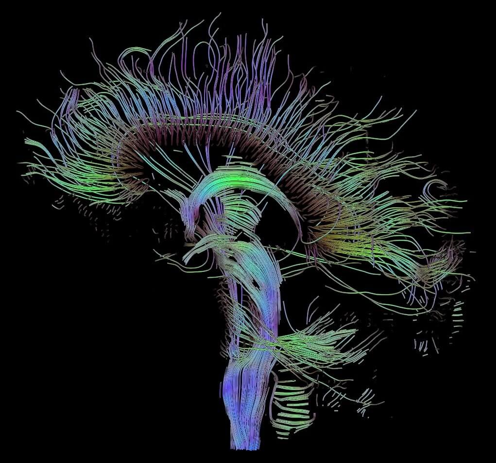 BrainMap - Mappa del cervello • Istituto BrainMap